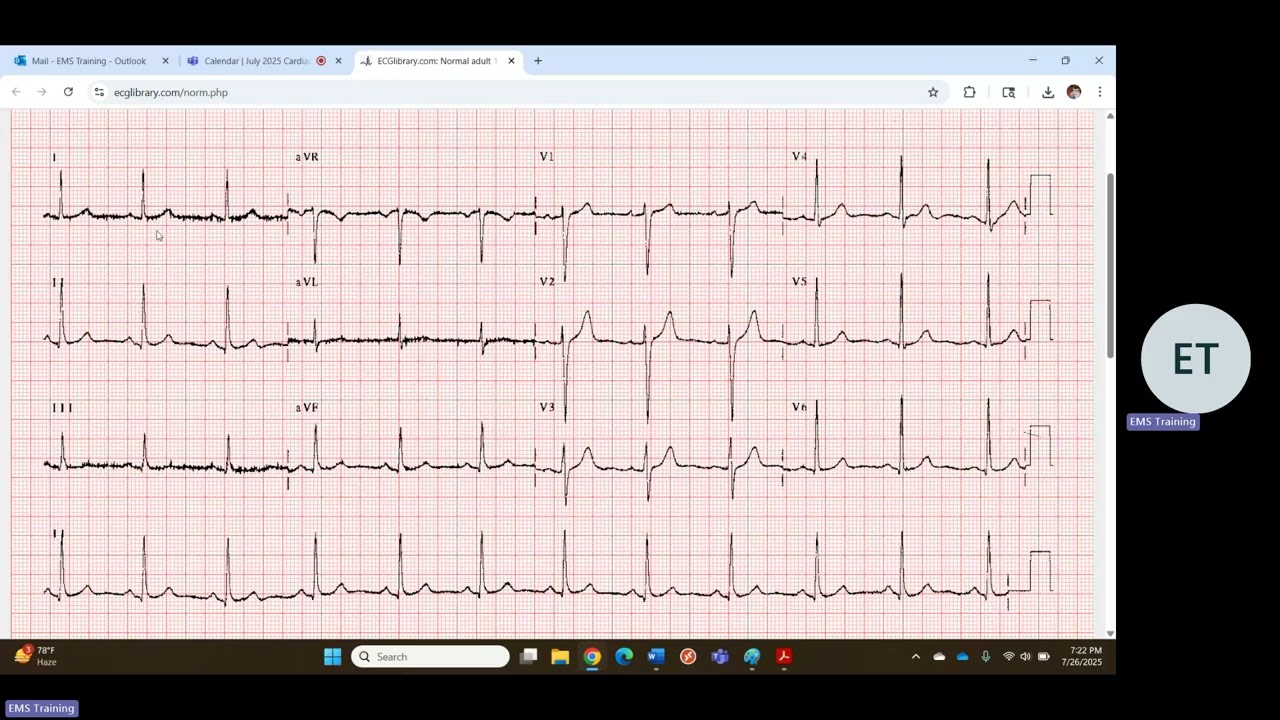 July 2025 Cardiac Tidbits 20250726 191509 Meeting Recording 1