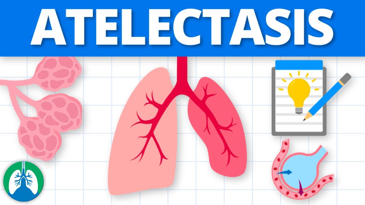 Atelectasis Tips for the Respiratory Therapy Board Exam