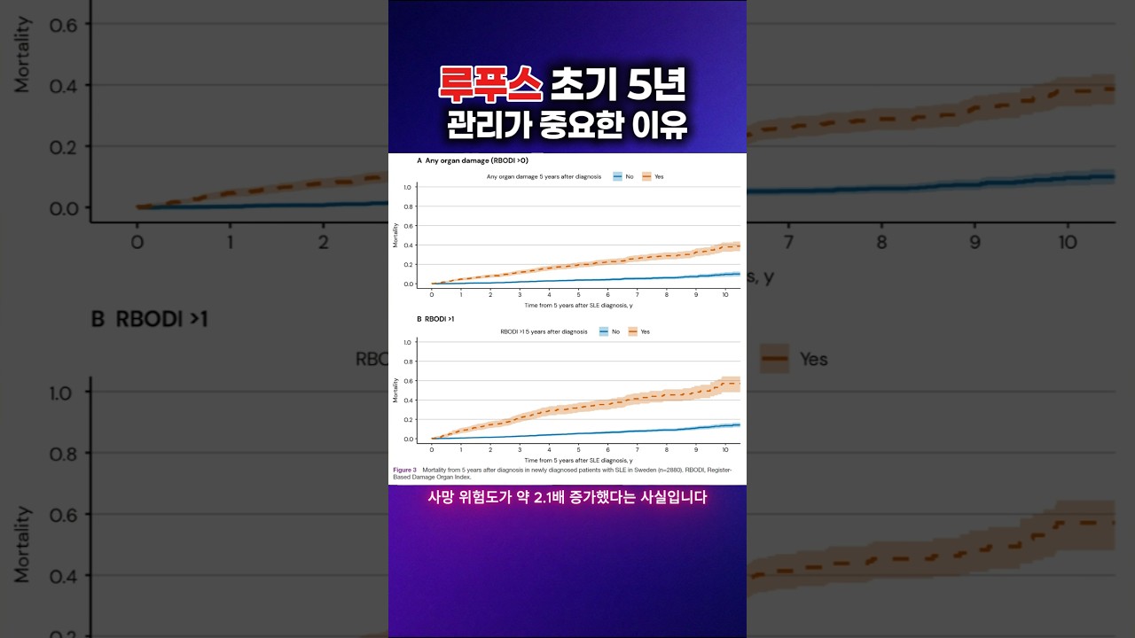 #루푸스 #조기치료 #예후