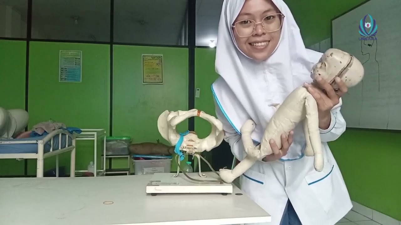 Mekanisme dan Teknik Persalinan Sungsang
