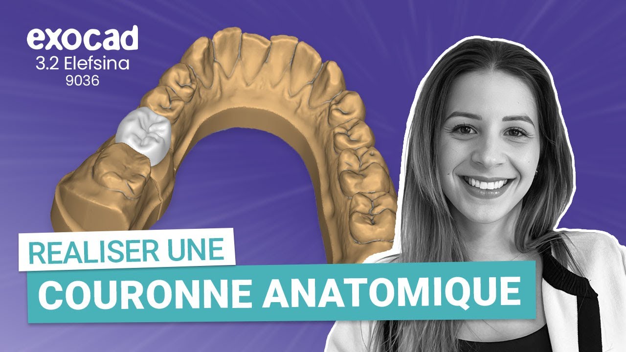 exocad elefsina 3.2 - Réaliser une Couronne Anatomique !