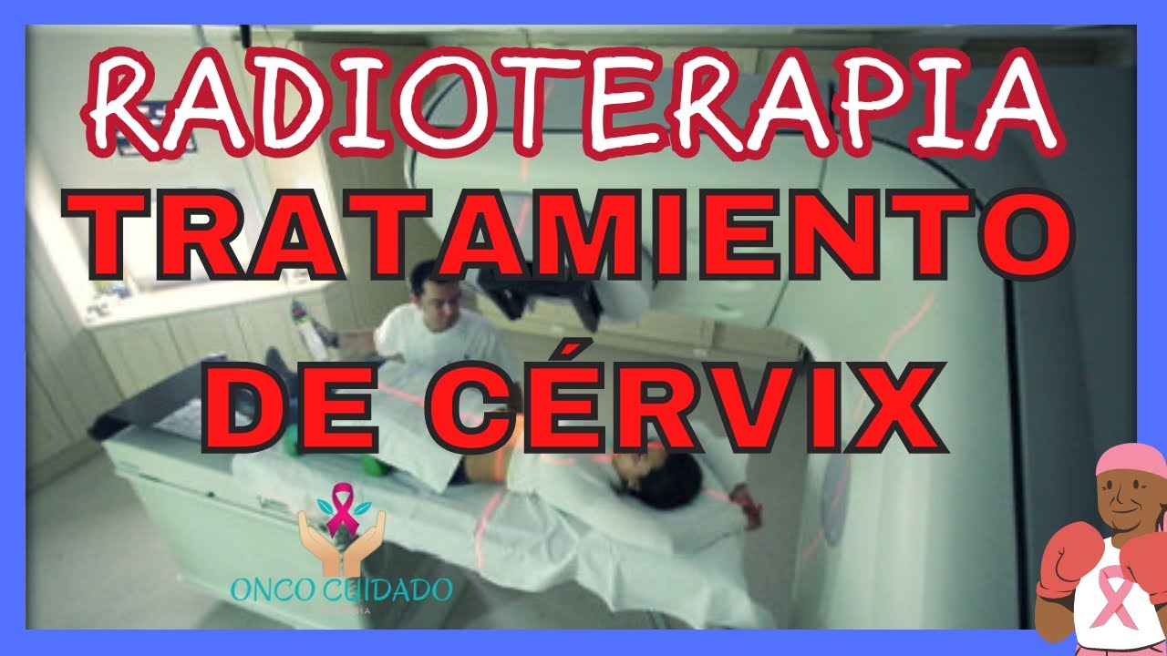 RADIOTERAPIA TRATAMIENTO DE CERVIX