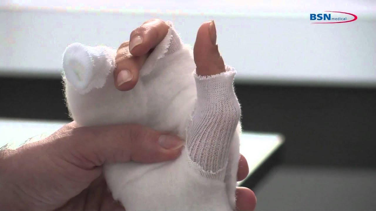 Plâtre Synthétique Application sur une fracture du boxeur_FR_de BSN medical.mov