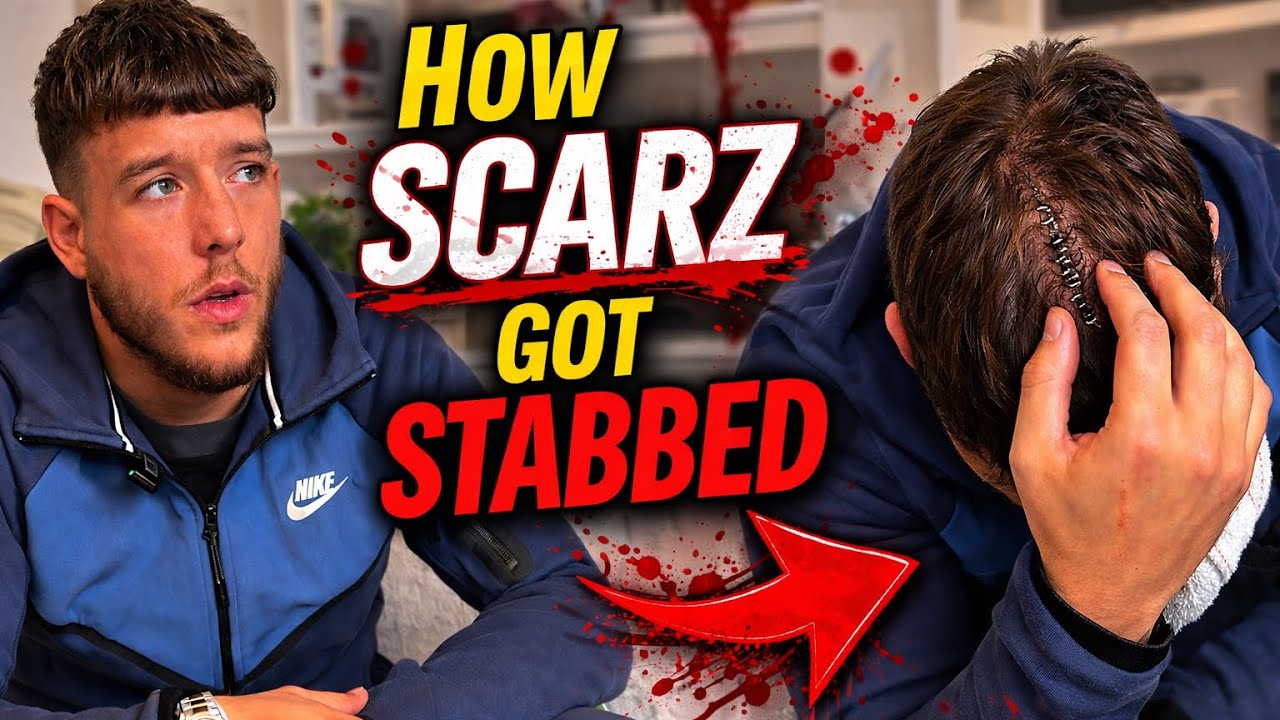 What Really Happened To SCARZ That Night&hellip; (Full Interview)