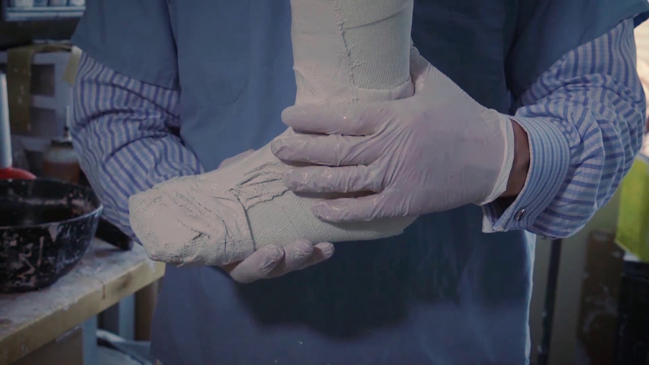 How A Custom AFO Is Made Part 2: Preparation and Pouring Plaster
