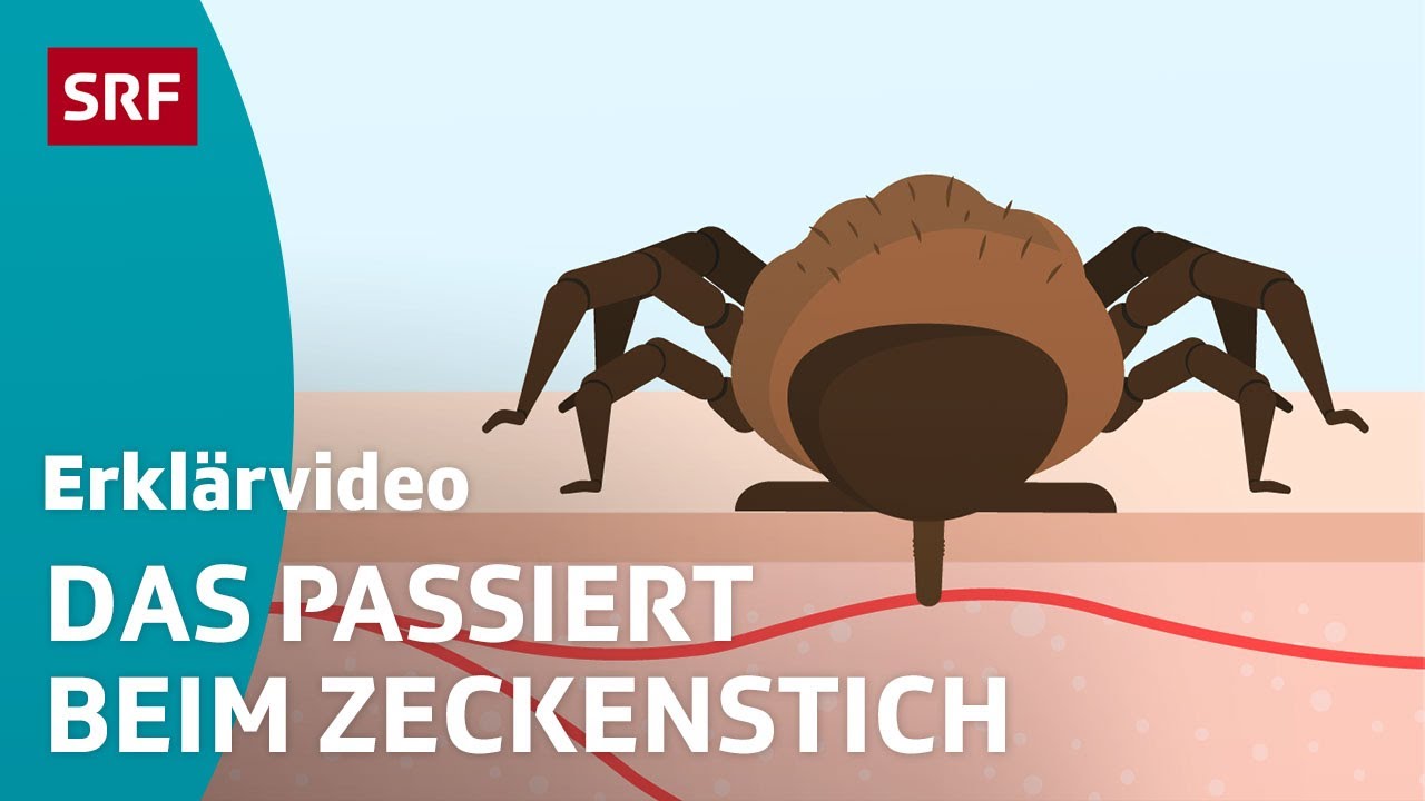 Zeckenstich & übertragbare Krankheiten – einfach erklärt | Kindervideos | SRF Kids