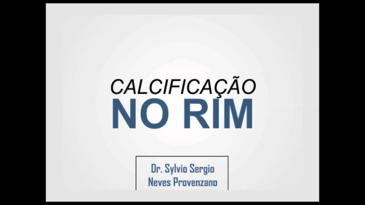 Calcificação no Rim - Dr. Sylvio Sergio Neves Provenzano