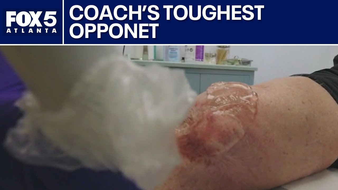 Piedmont Atlanta keeps football coach from losing leg | FOX 5 Atlanta