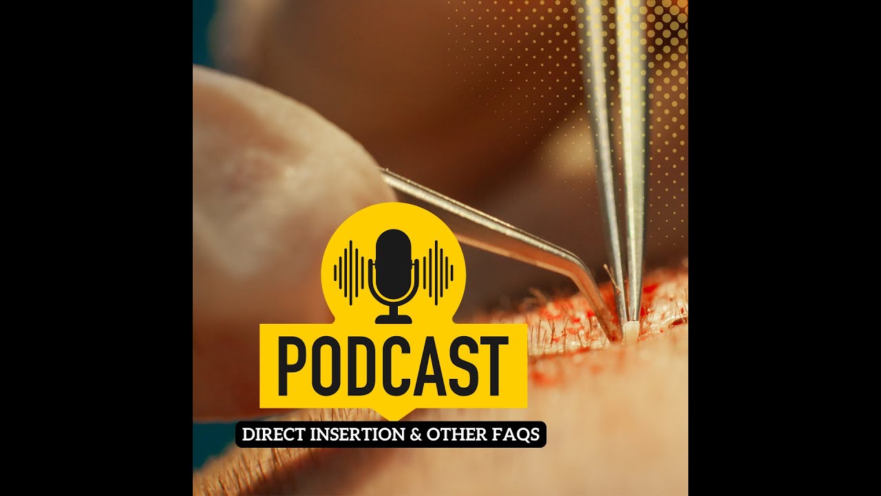 Hair Transplant in India | Live@6  #podcast