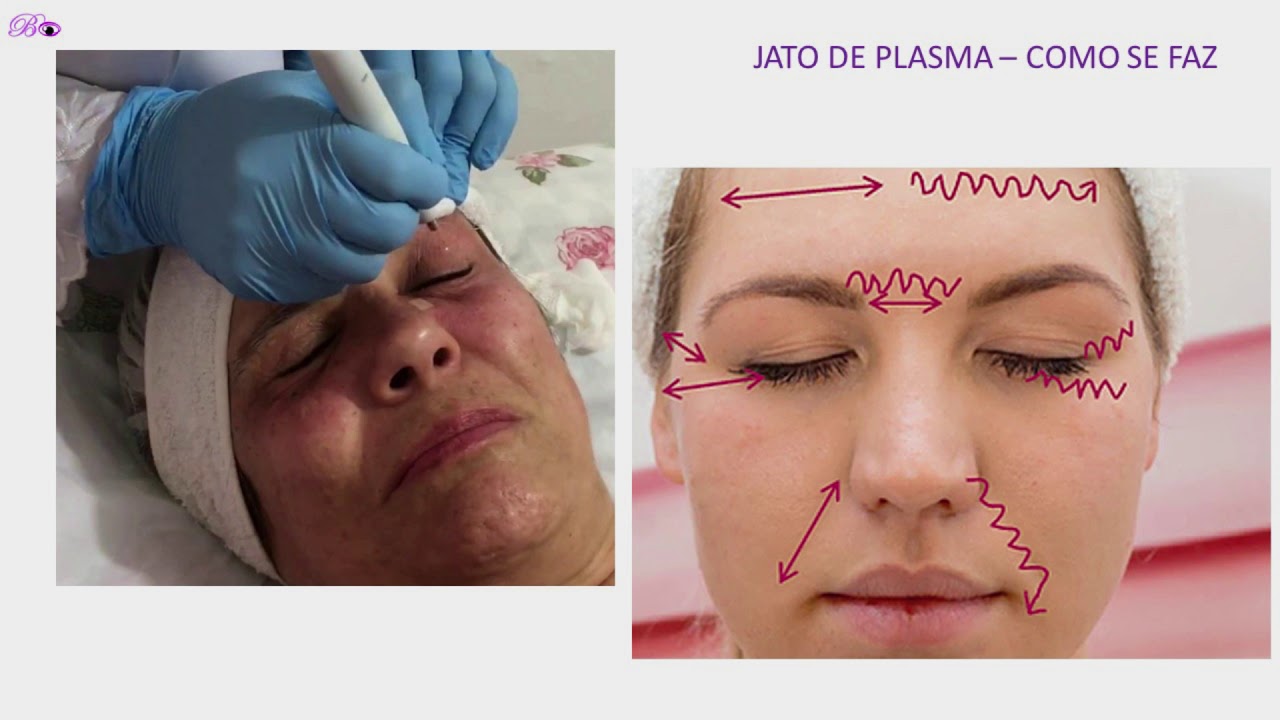Curso Jato de Plasma - Parte 10 - Como se faz