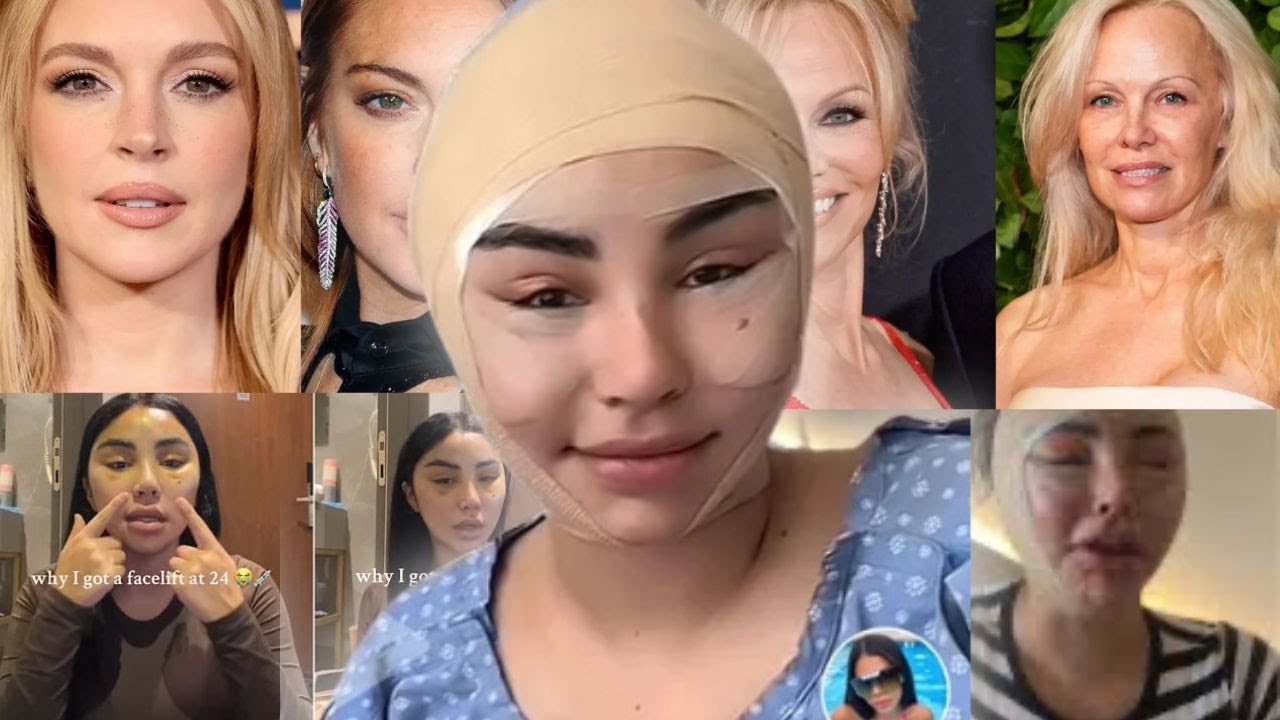 Facelift at 24?? Why preventive aging is making you Ugly