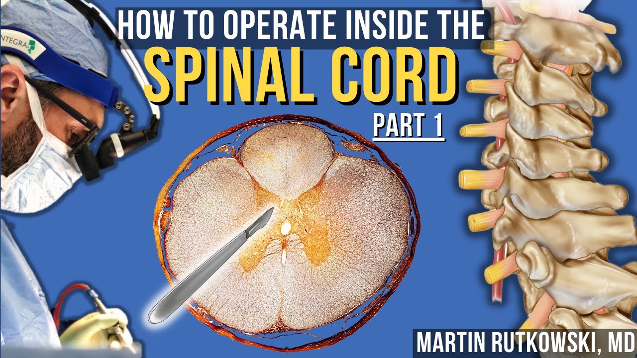 Neurosurgeon Explains - How to Operate Inside the Spinal Cord - Part 1