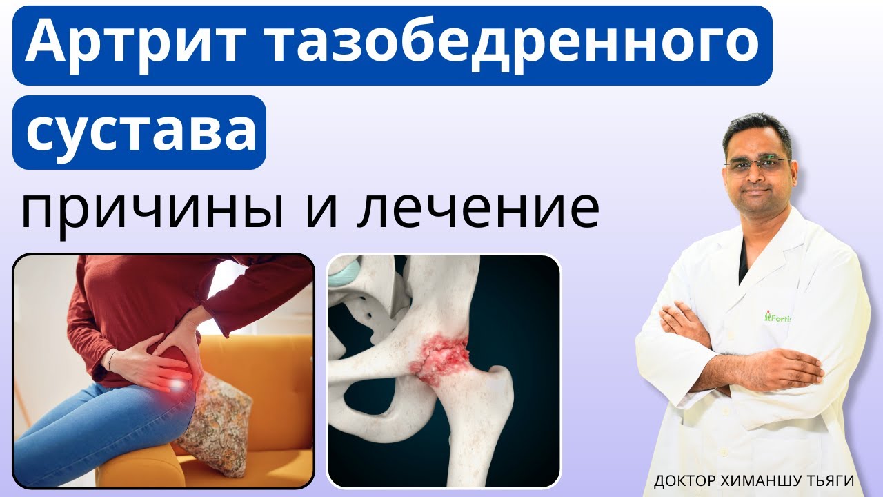Артрит тазобедренного сустава – причины и лечение | Hip Arthritis - Causes & Treatment in Russian