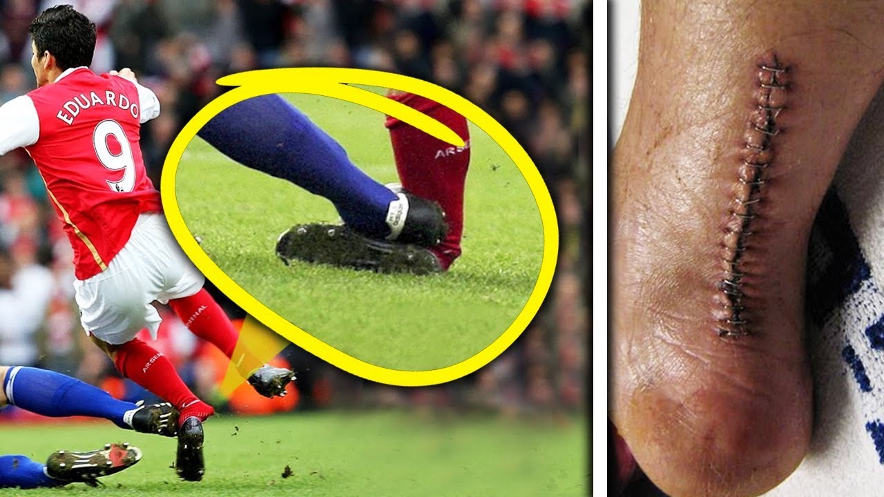 Careers RUINED By Injury XI