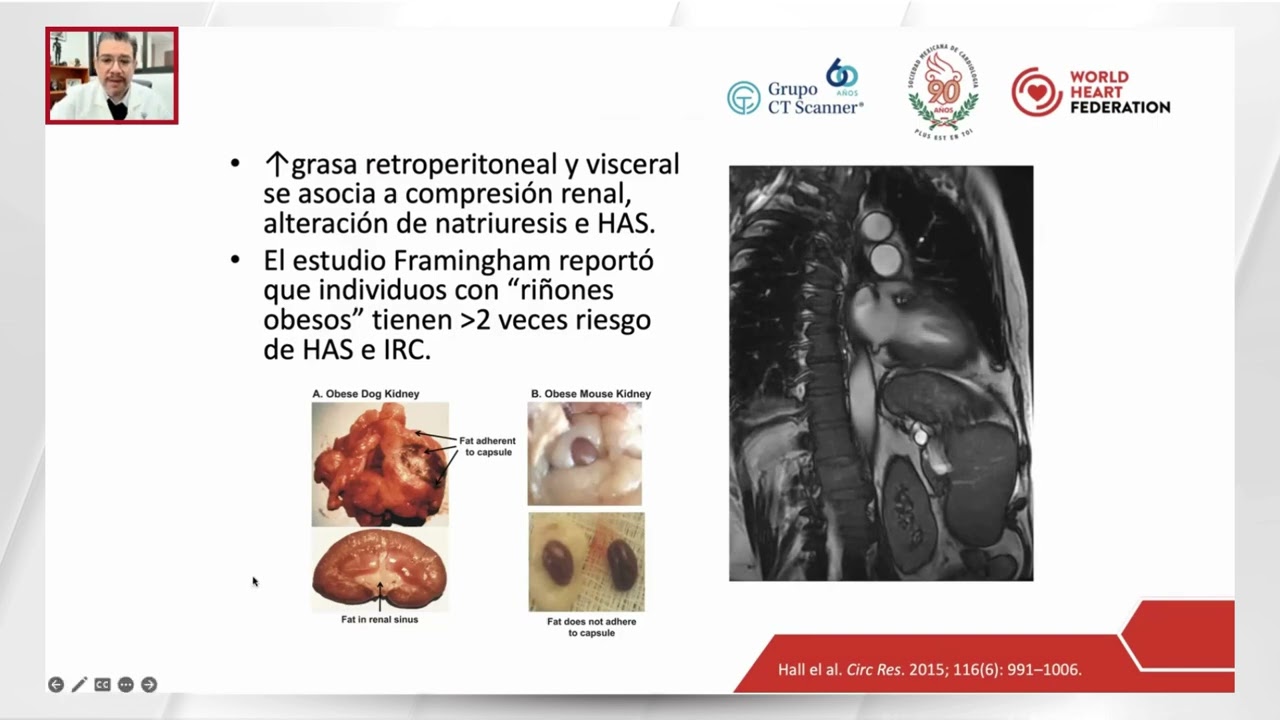 Obesidad y el síndrome cardio-metabólico-renal
