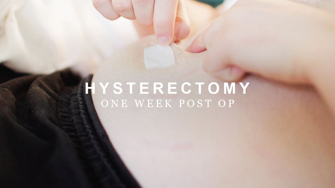 1 Week Post Hysterectomy | FTM