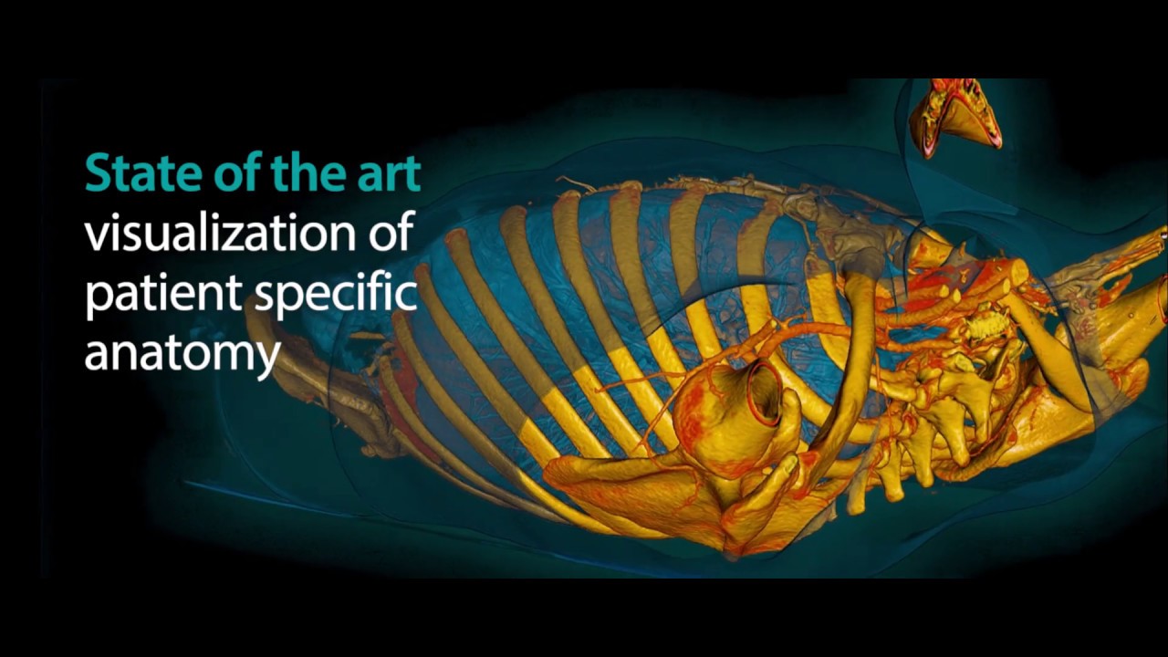 Vesalius3D: 3D Medical Imaging Made Easy