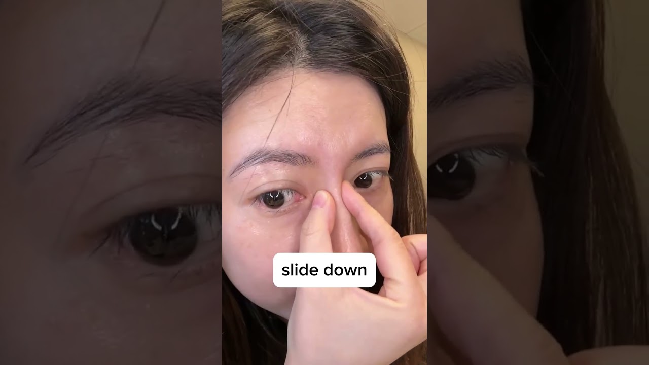 Improve your vision naturally with acupressure