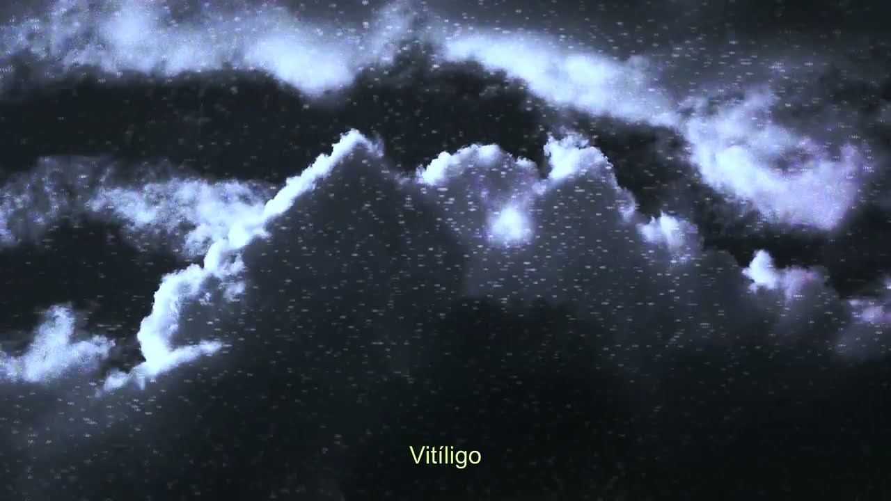 Vac&iacute;os Cuerpos - Vit&iacute;ligo (Visualizer)