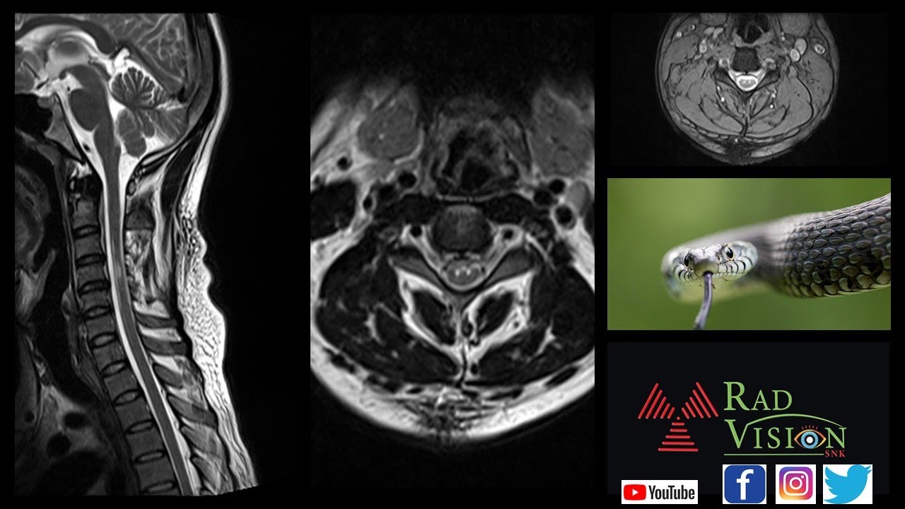 MD/DMRD/DNB STUDENTS RADIOLOGY SPOTTERS SET II 51 TO 100