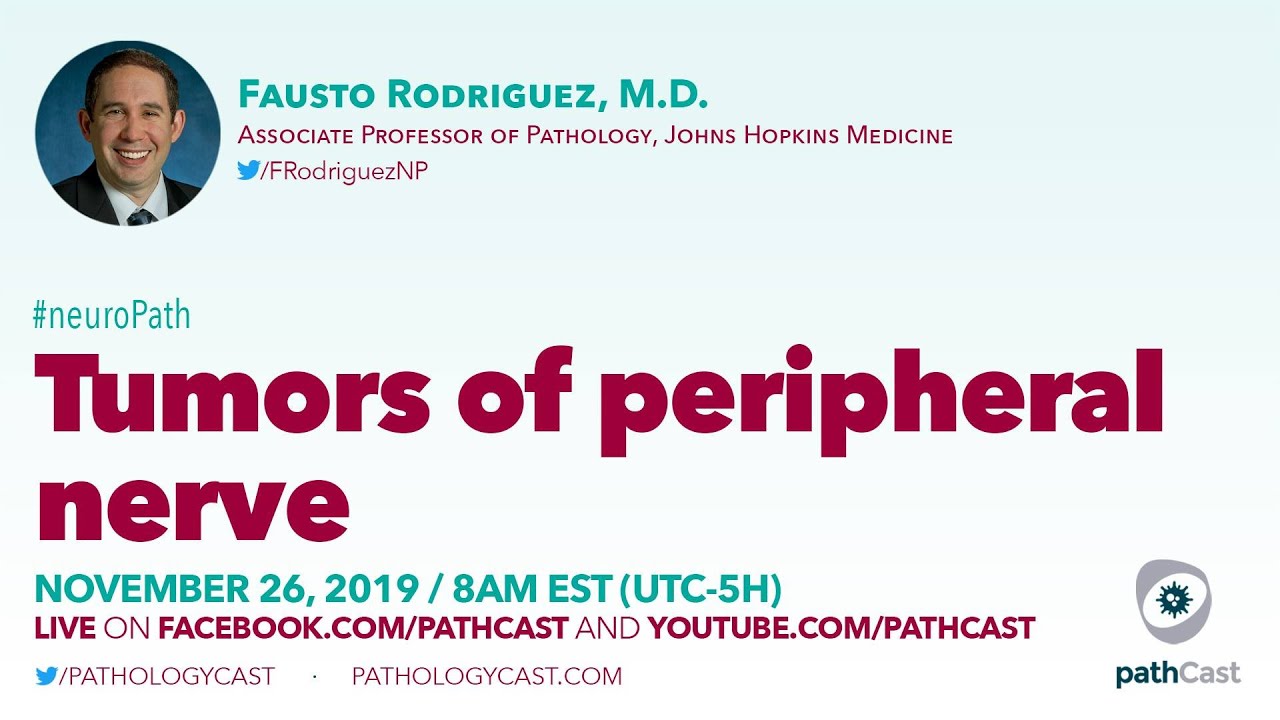 Tumors of peripheral nerve - Dr. Rodriguez (Hopkins) 