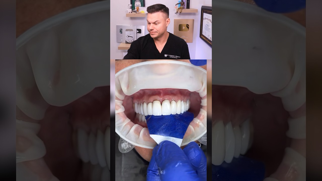 Dentist Reveals Surprising Top Reason For TOOTH Pain! 😭🦷