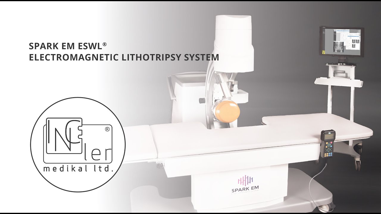 Spark EM ESWL  Electromagnetic Lithotripsy System