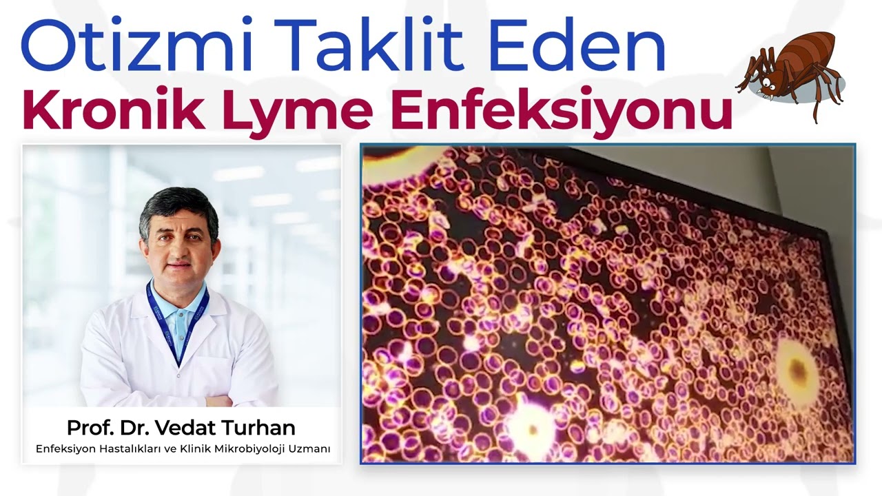 Lyme Hastalığında Karanlık Saha İncelemesi | Lyme Hastalığı | Karanlık Saha | Prof. Dr. Vedat Turhan