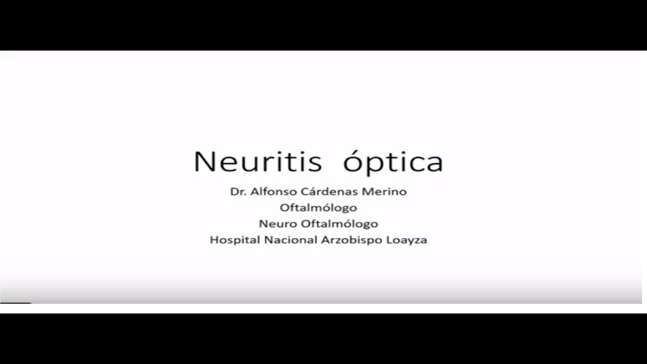 NEURITIS ÓPTICA