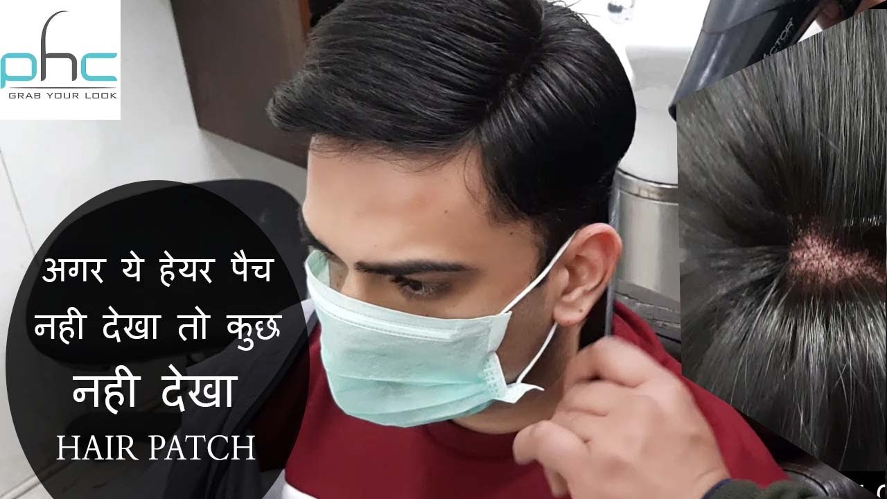 Hunk Look Hair Patch with Oxidation by Planet of Hair Cloning Call Experts +91 9899746489