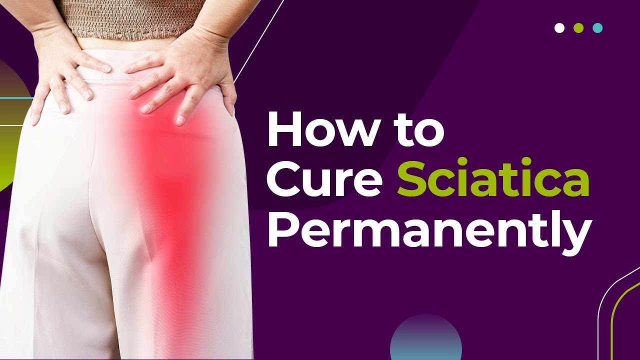 How to Cure Sciatica Permanently