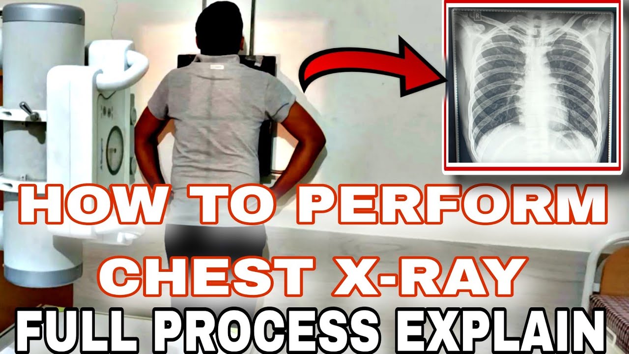 How to perform chest X-ray |Chest X-ray kaise hota hai | Chest X-ray process explain #cxr #chestxray
