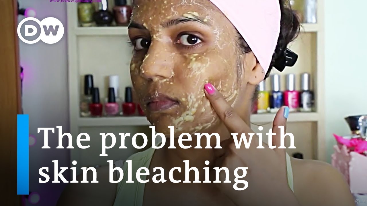 Why you should stop bleaching your skin right now | DW Stories
