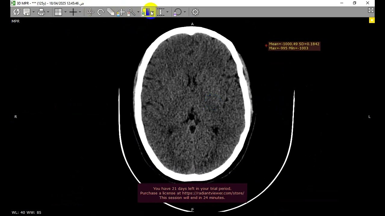 case discussion 3