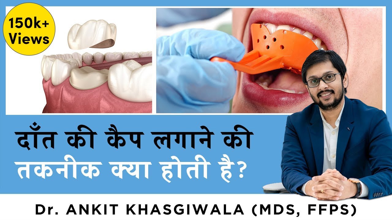 दांतों में कैप कैसे लगाया जाता है | tooth cap fitting | teeth capping process