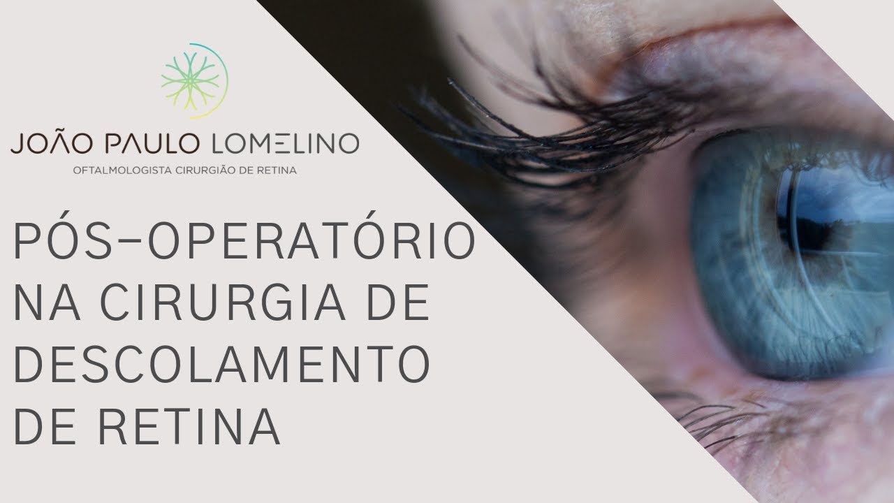 Pós operatório na Cirurgia de descolamento de Retina com Dr. João Paulo Lomelino