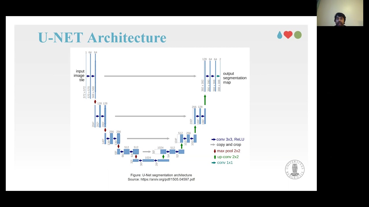 Automatic Polyp Segmentation using U-Net-ResNet50