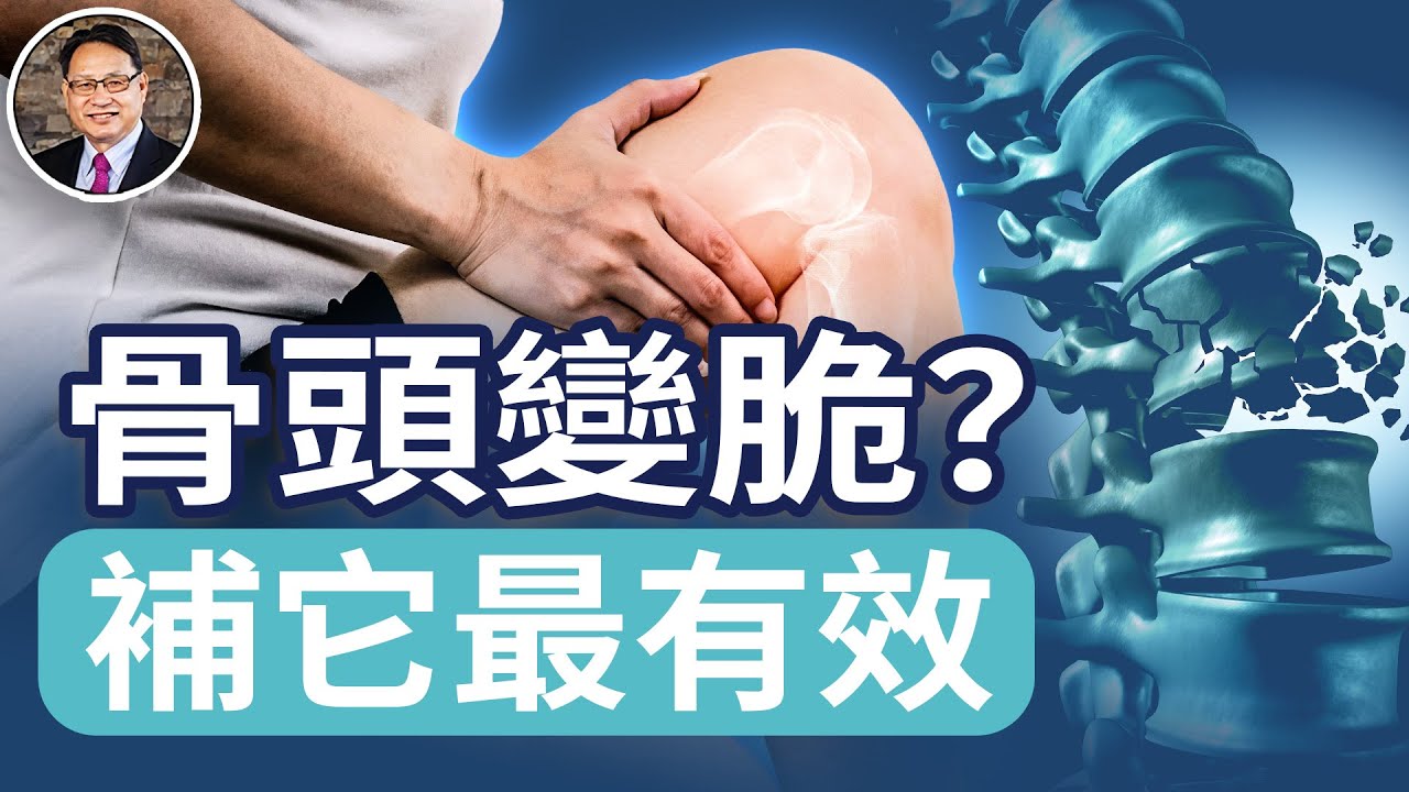 為什麼更年期骨頭變脆？HRT如何治療骨質疏松？專為亞洲女性設計的深度解析！｜四維健康