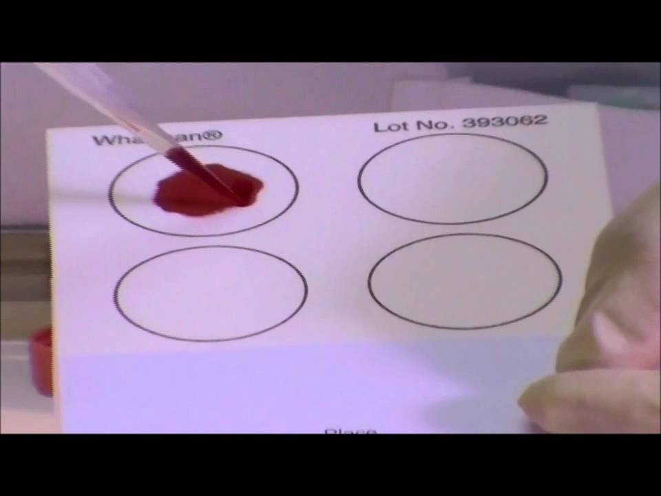 Making Dried Blood Spots on Whatman FTA Cards