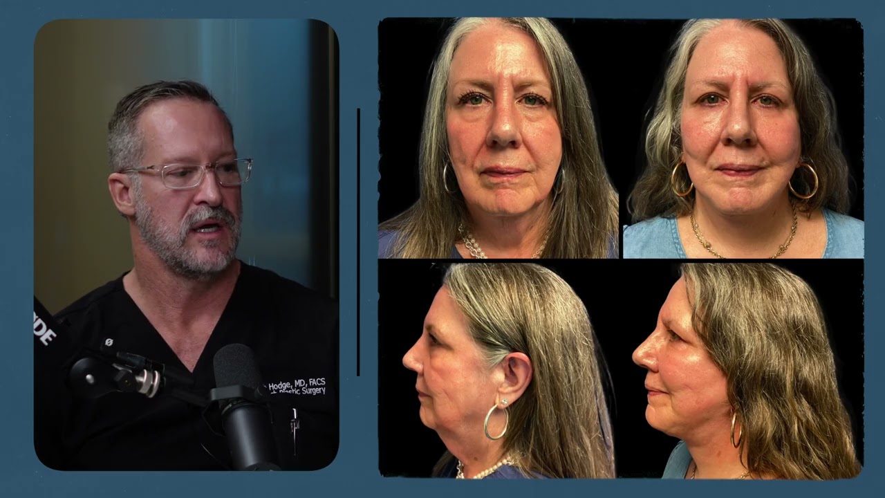 Facelifts and Fat Grafting with Dr. Keith Hodge