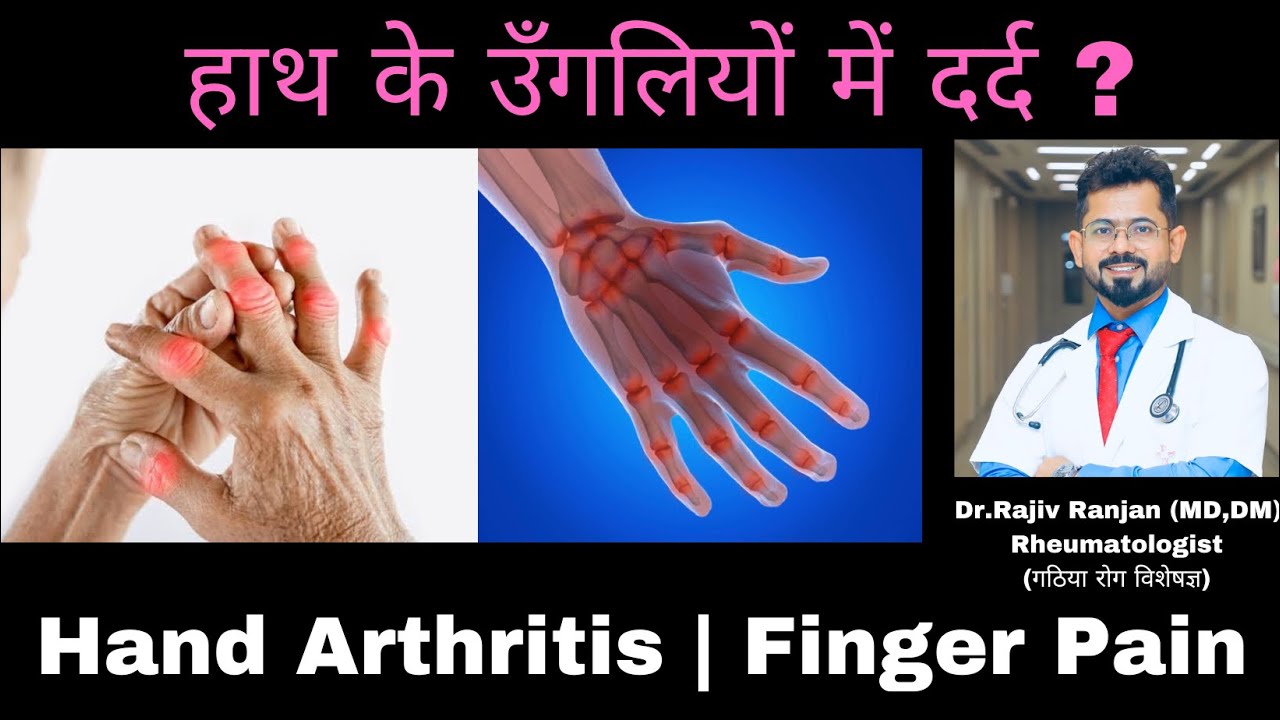 हाथ के जोड़ो में दर्द | उँगलियों में दर्द | Hand Arthritis | Finger Pain