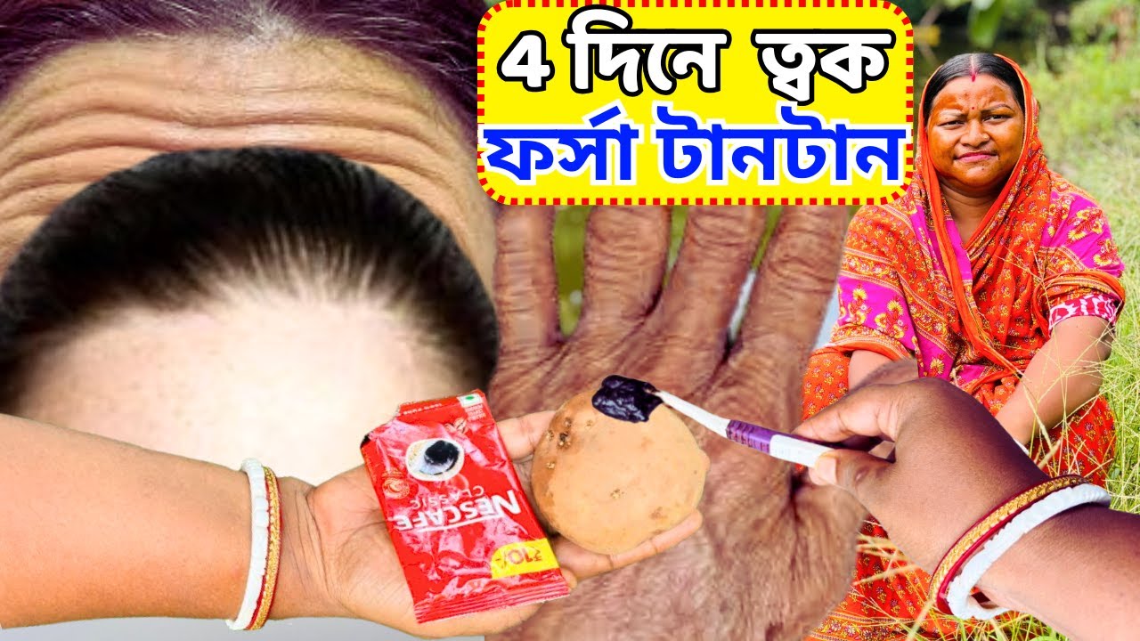 70 বছর বয়সী ত্বক 20 মত টানটান ফর্সা করুন মাত্র 4 দিনে / Glowing skin