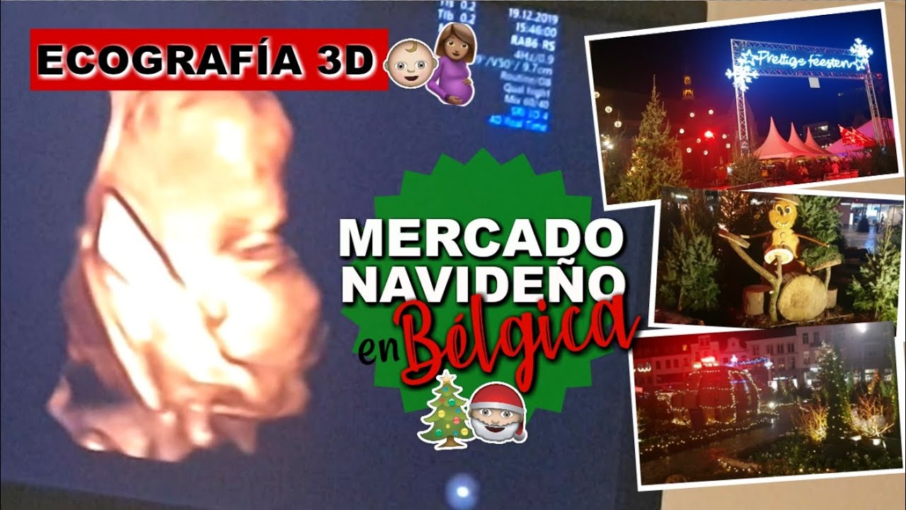 VAMOS AL MÉDICO | MERCADO NAVIDEÑO EN BÉLGICA - foreverYuvelyn