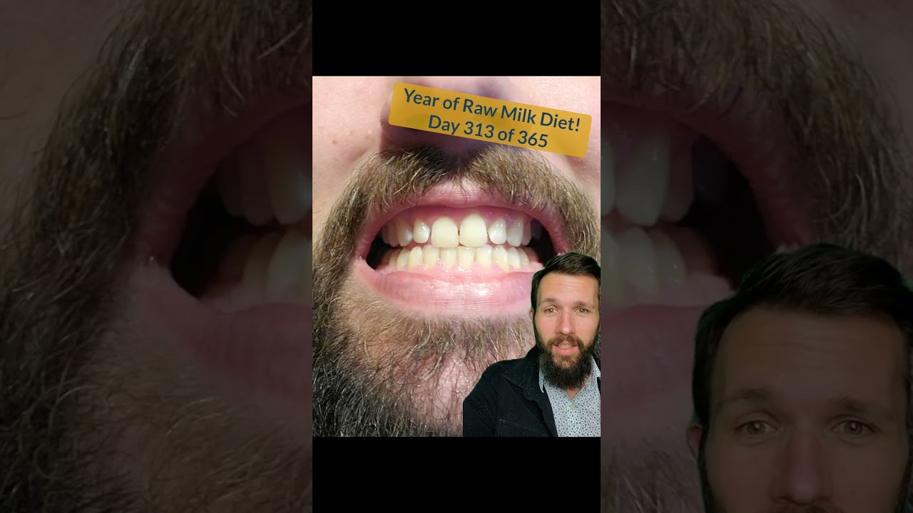 Day 313 of One Year of Raw Milk Diet!