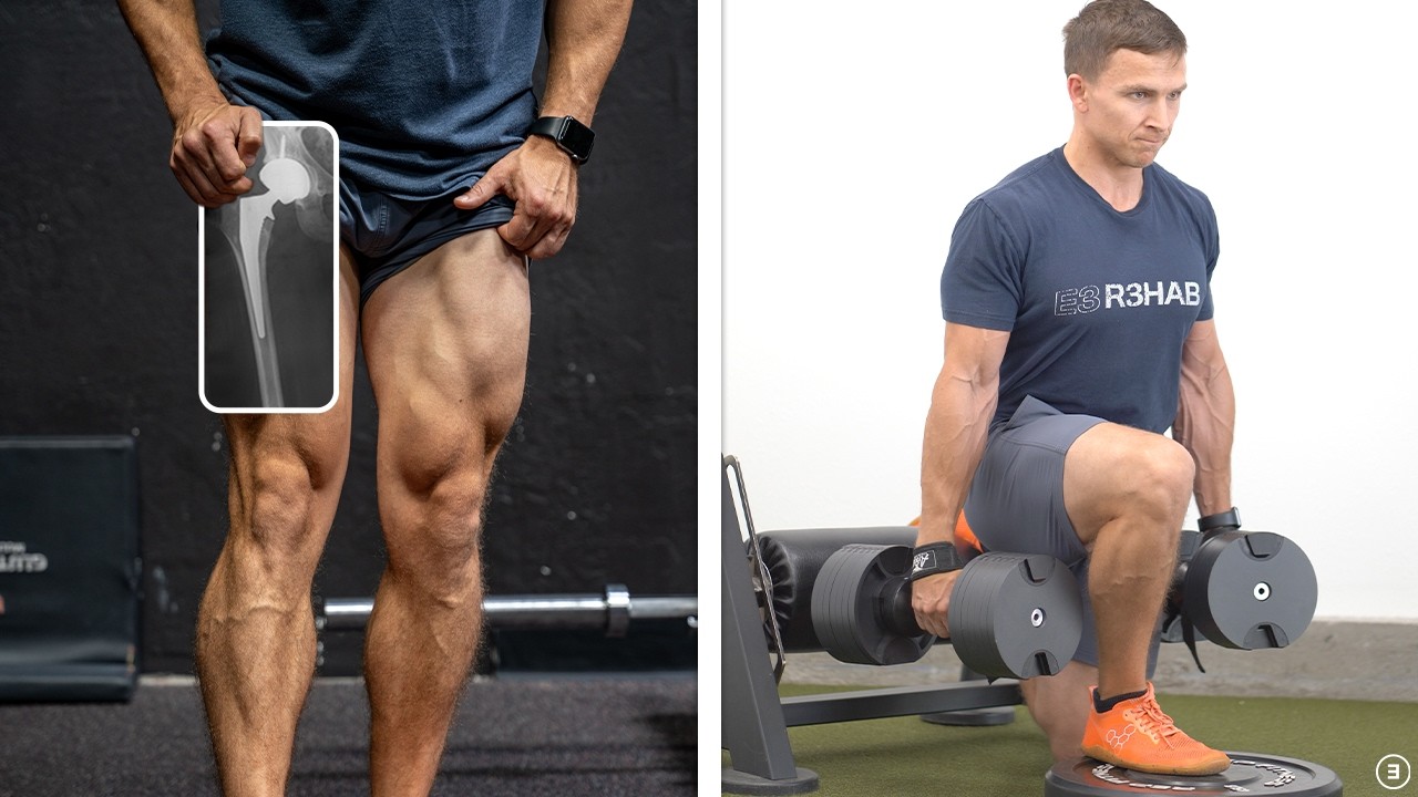 Total Hip Replacement at 19 Years Old (16 Years Later)