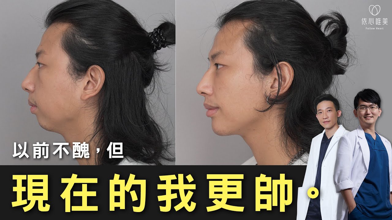 整形後狂被正妹搭訕？好處實在數不完🤑下巴後縮 3D列印下巴 眼袋手術｜依心唯美 謝東穎醫師 林子宇醫師ft.Jason自由攝影師 @jjjason0826