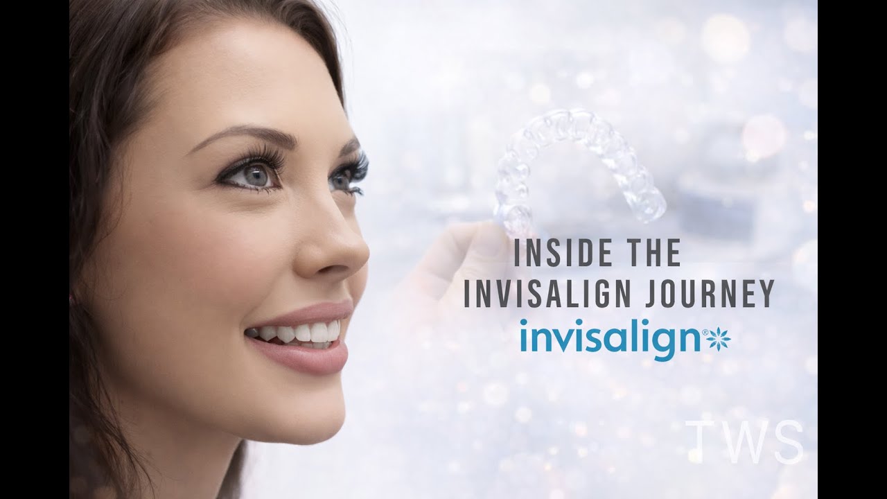 Inside an Invisalign Journey | From Consultation to Final Smile