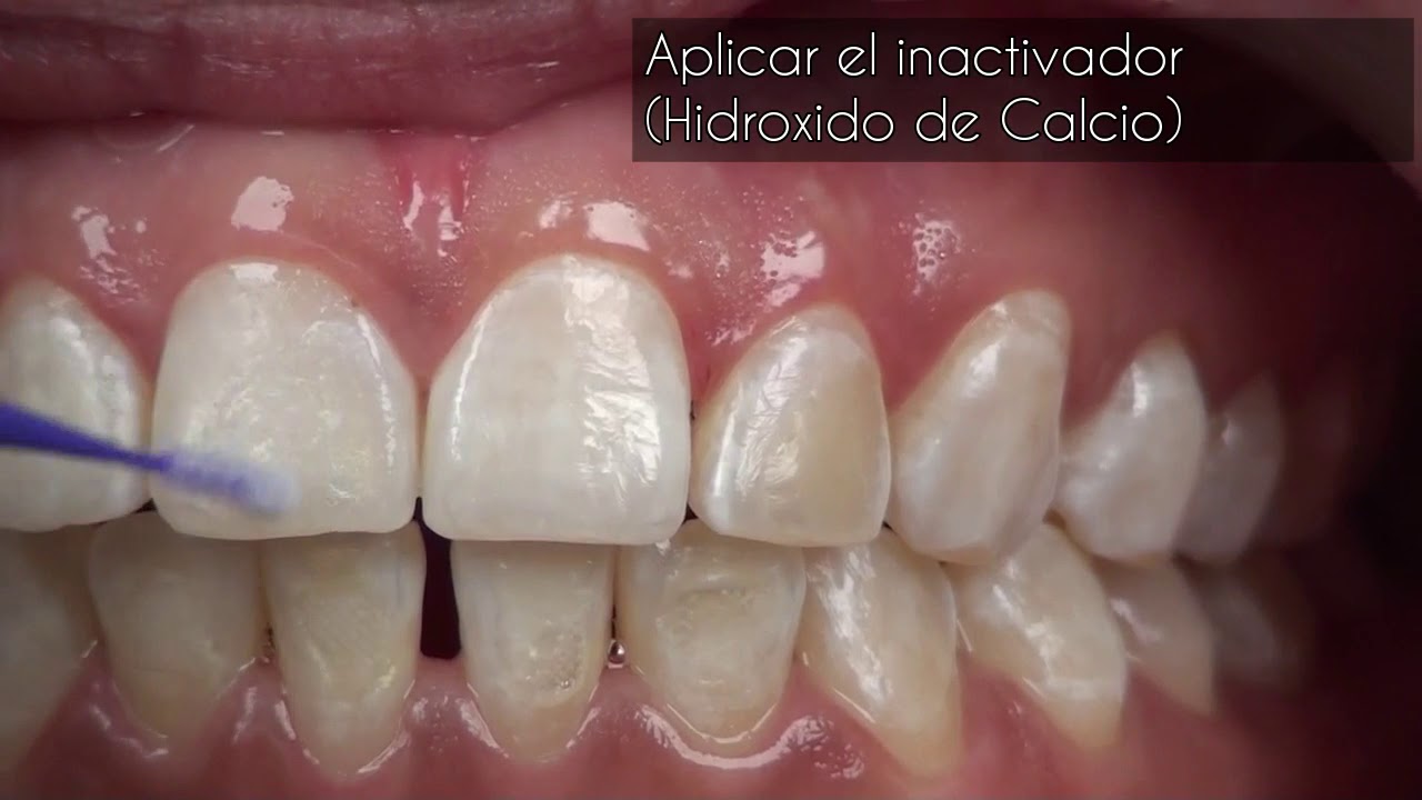 Manejo de lesiones Blancas con Antivet