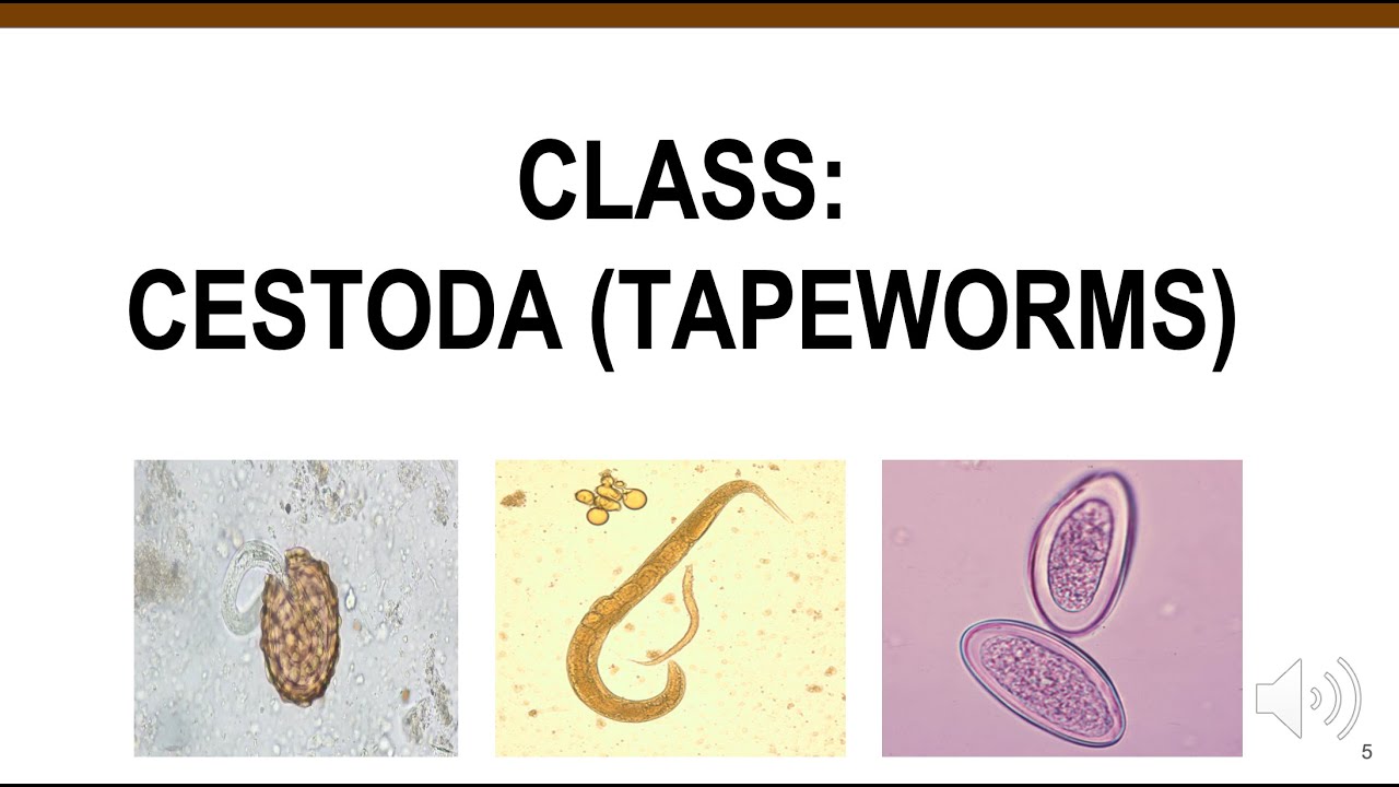 Cestodes