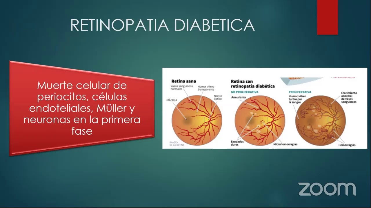 VASCULARIZACION RETINIANA Y COROIDEA